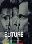 Suture
